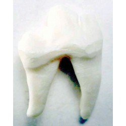 Tooth, White, replaceable (1M) (26-50)