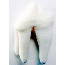 Tooth, White, replaceable (4P) (5-15) (5 min)