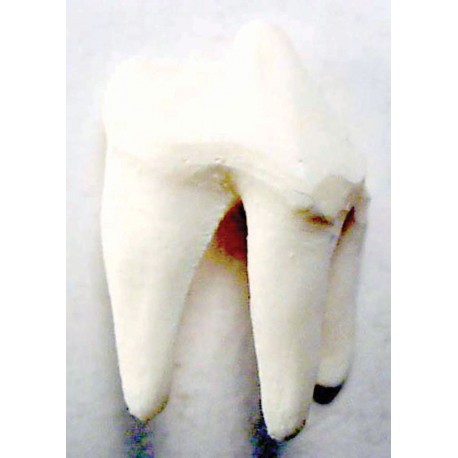 Tooth, White, replaceable (P4) (16-25)