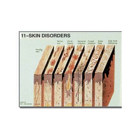 Edupad Skin disorders